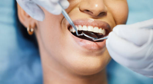 Best Emergency Dentist for Lost Fillings or Crowns in Salix, PA